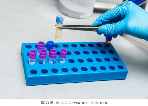 干细胞悬浮液的液氮库用于生物医学诊断的细胞培养